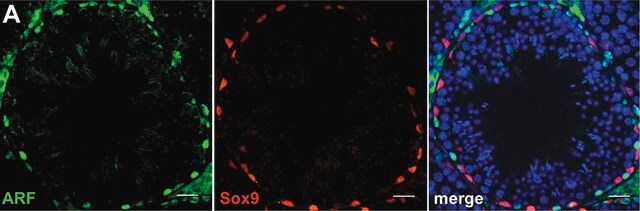 Anti-Sox9 Antibody Chemicon&#174;, from rabbit