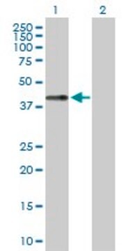 Anti-LECT1 antibody produced in rabbit purified immunoglobulin, buffered aqueous solution