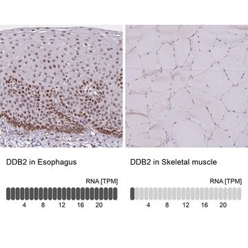 Anti-DDB2 antibody produced in rabbit Prestige Antibodies&#174; Powered by Atlas Antibodies, affinity isolated antibody, buffered aqueous glycerol solution