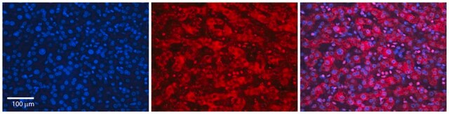 抗SLC26A3抗体 ウサギ宿主抗体 affinity isolated antibody