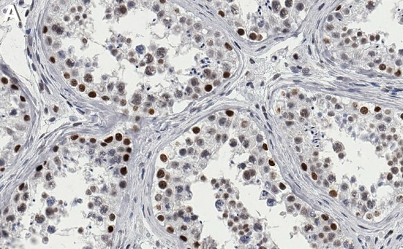 Anti-Ku70/XRCC6 Antibody, clone 1D19-L1 ZooMAb&#174; Rabbit Monoclonal recombinant, expressed in HEK 293 cells