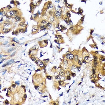 Anti-Ube2N/Ubc13 antibody produced in rabbit