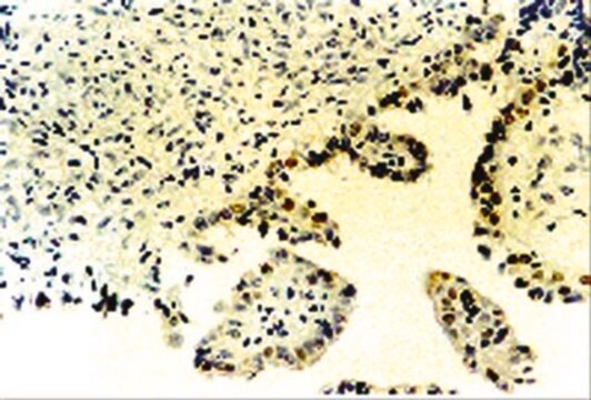 Anti-p73 Antibody, &#945; and &#946; Chemicon&#174;, from rabbit