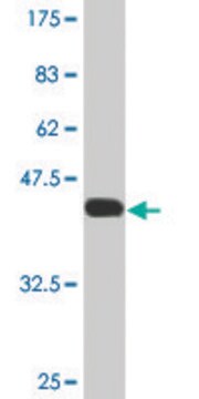 Monoclonal Anti-FABP4 antibody produced in mouse clone 2F12-1B11, ascites fluid, solution