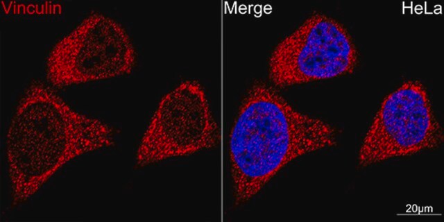 Anti-Vinculin Antibody, clone 9I3Y8, Rabbit Monoclonal