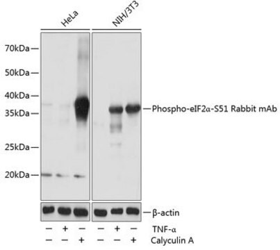 Anty-fosfo-eIF2α-S51