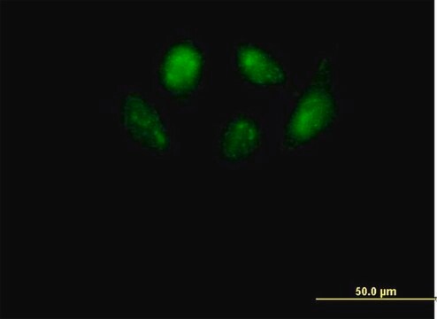 Anti-SMU1 antibody produced in mouse purified immunoglobulin, buffered aqueous solution