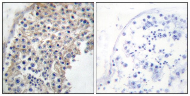 抗-肾上腺素受体 &#945;-2A 兔抗 affinity isolated antibody