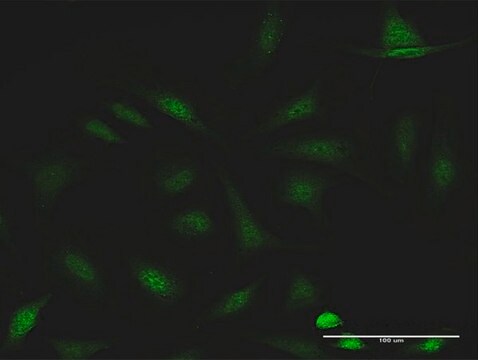 Anti-CCDC6 antibody produced in rabbit purified immunoglobulin, buffered aqueous solution