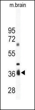 Anti-ART4 (C-term) antibody produced in rabbit IgG fraction of antiserum, buffered aqueous solution