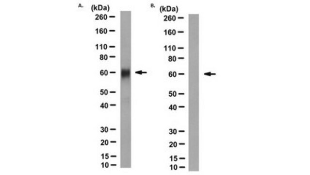 Anti-hLYVE-1 Antibody, clone 8C clone 8C, from mouse