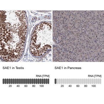 Anti-SAE1 antibody produced in rabbit Prestige Antibodies&#174; Powered by Atlas Antibodies, affinity isolated antibody, buffered aqueous glycerol solution