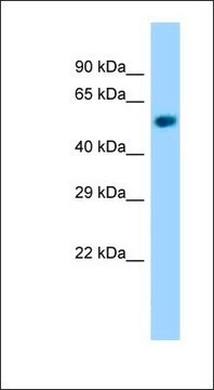 Anti-NAPRT1 antibody produced in rabbit affinity isolated antibody