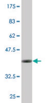 Monoclonal Anti-EXOSC4, (N-terminal) antibody produced in mouse clone 4F9, purified immunoglobulin, buffered aqueous solution