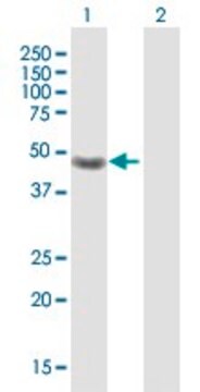 Anti-CRELD1 antibody produced in rabbit purified immunoglobulin