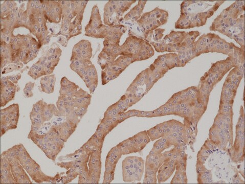 Anti-PSA (Prostate Specific Antigen) antibody, Rabbit monoclonal recombinant, expressed in HEK 293 cells, clone RM323, purified immunoglobulin