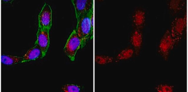 Anti-Bak (NT) Antibody from rabbit, purified by affinity chromatography