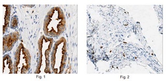 Anti-Rab27B, clone 6C10.1 Antibody clone 6C10.1, from mouse