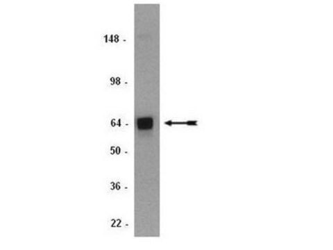 Anti-ADAMTS-1 Antibody, clone 5D4E11B6 serum, clone 5D4E11B6, Chemicon&#174;