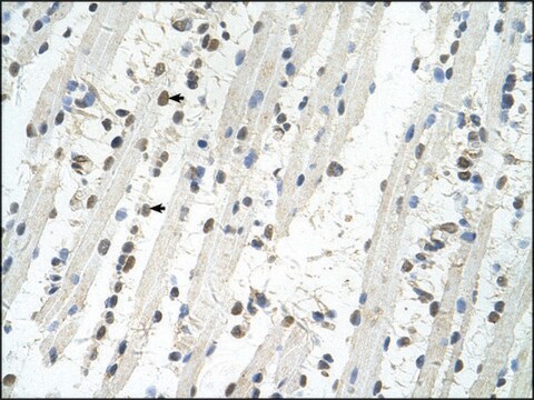 Anti-TRIM32 (AB2) antibody produced in rabbit IgG fraction of antiserum