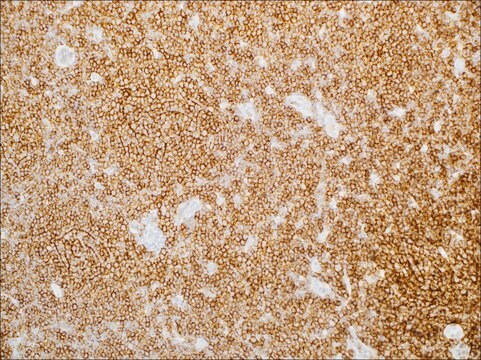 CD23 (EP75) Rabbit Monoclonal Primary Antibody