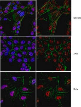 Anti-Twist1 (Twist-related protein 1) Antibody from rabbit, purified by affinity chromatography