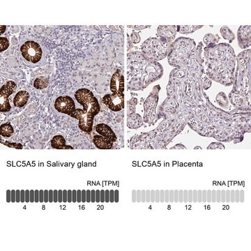 Anti-SLC5A5 antibody produced in rabbit Prestige Antibodies&#174; Powered by Atlas Antibodies, affinity isolated antibody, buffered aqueous glycerol solution