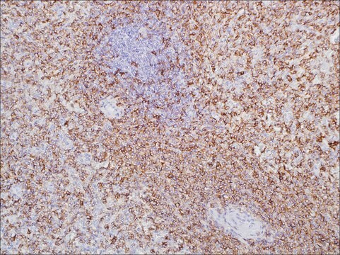 CD11c (EP157) Rabbit Monoclonal Primary Antibody