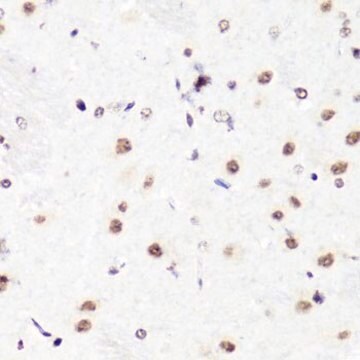 Anti-Asymmetric DiMethyl-Histone H3-R2 antibody produced in rabbit