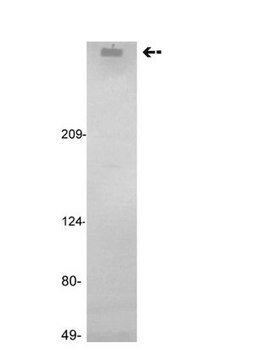 Anti-Factor VIII Antibody, clone GMA-012 clone GMA-012, Upstate&#174;, from mouse