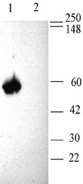 Przeciwciało przeciwko kanałowi wapniowemu β3 bramkowanemu napięciem Chemicon&#174;, from rabbit