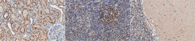 Anti-LMO-2 (Rhombotin-2) Antibody, clone 1A9-3B11 clone 1A9-3B11, from mouse