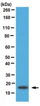 Anti-Fatty-acid binding protein 5 Antibody from rabbit