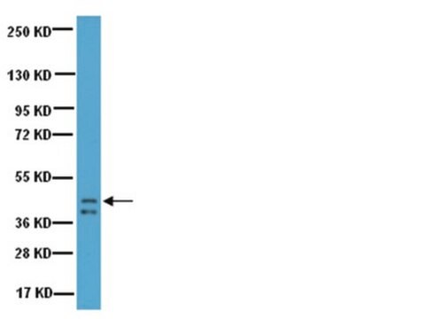 Anticorpo anti-proteína 43 associada ao crescimento (GAP-43) Chemicon&#174;, from rabbit