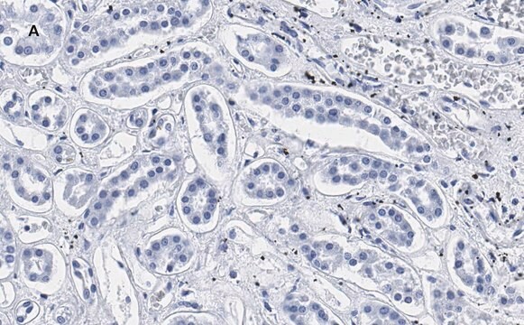 抗Smad3抗体 クローン1J11 ZooMAb&#174;ウサギモノクローナル recombinant, expressed in HEK 293 cells