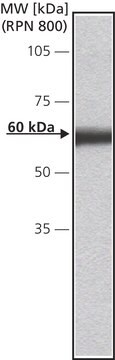 Anti-Calsequestrin-1 (N-terminal) in Kaninchen hergestellte Antikörper affinity isolated antibody