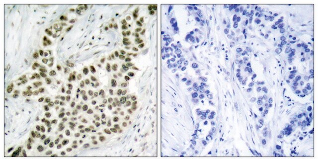 Anti-Histone H2A.X antibody produced in rabbit affinity isolated antibody