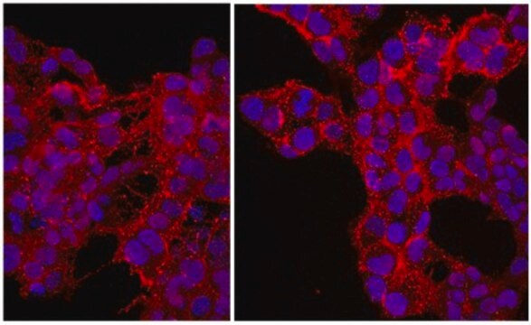 Anticuerpo anti-proteoglucano sulfato de condroitina NG2, conjugado con Cy3 from rabbit, CY3 conjugate