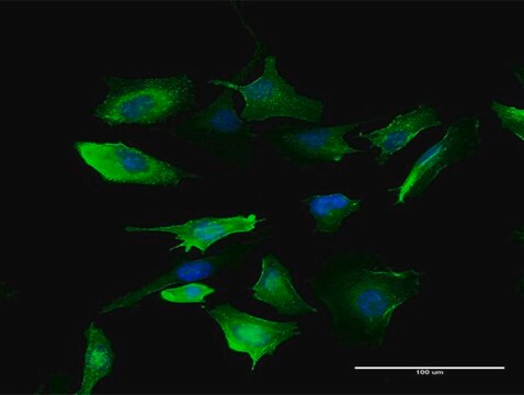 Anti-S100A10 antibody produced in mouse purified immunoglobulin, buffered aqueous solution