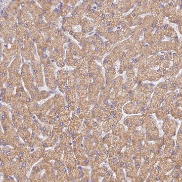 Anti-UTP23 antibody produced in rabbit Prestige Antibodies&#174; Powered by Atlas Antibodies, affinity isolated antibody, buffered aqueous glycerol solution