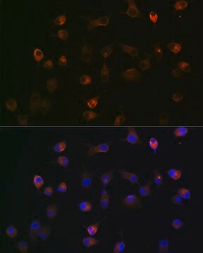 Anti-&#947;-Catenin Antibody, clone 9O2K8, Rabbit Monoclonal