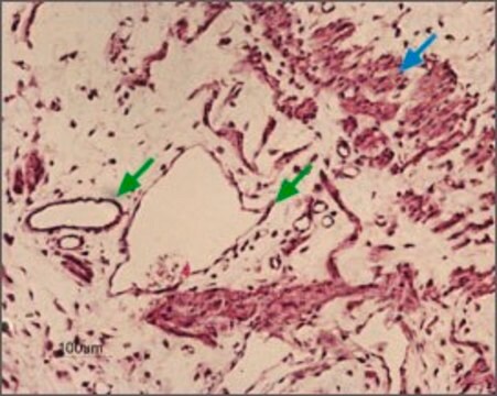 Anti-Potassium Channel KIR6.1 antibody produced in rabbit affinity isolated antibody, lyophilized powder