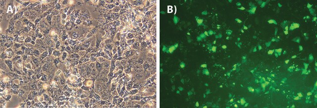 GenElute&#8482; HP Endotoxin-Free Plasmid Maxiprep Kit sufficient for 4&#160;preparations