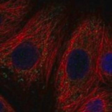 Anti-SLC11A1 antibody produced in rabbit Prestige Antibodies&#174; Powered by Atlas Antibodies, affinity isolated antibody, buffered aqueous glycerol solution