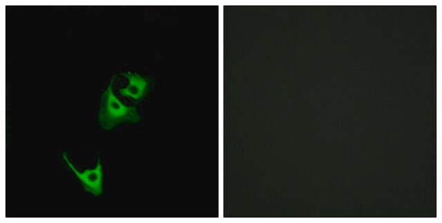 抗-GLP1R 兔抗 affinity isolated antibody