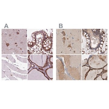 Anti-GANAB antibody produced in rabbit Prestige Antibodies&#174; Powered by Atlas Antibodies, affinity isolated antibody, buffered aqueous glycerol solution