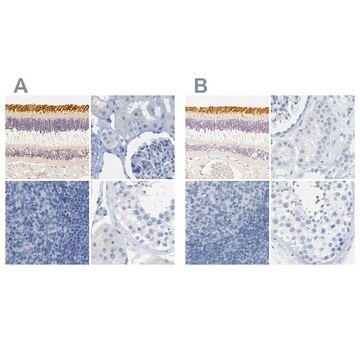 Anti-OPN1SW antibody produced in rabbit Prestige Antibodies&#174; Powered by Atlas Antibodies, affinity isolated antibody