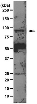 Anti-SUZ12-Antikörper, Klon 2AO9 clone 2AO9, from mouse