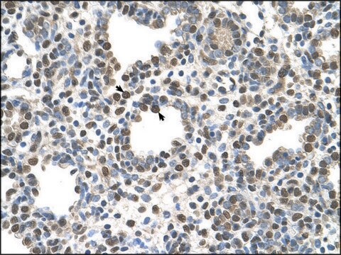 Anti-ZDHHC13 antibody produced in rabbit IgG fraction of antiserum