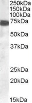 Anti-HIP14L/ZDHHC13 antibody produced in goat affinity isolated antibody, buffered aqueous solution